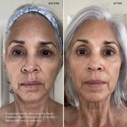 SK-II PITERA™ YÜZ BAKIM ESANSI