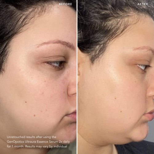SK-II GENOPTICS ULTRAURA ESANS SERUM - PARLATICI SERUM