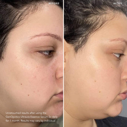 SK-II GENOPTICS ULTRAURA ESANS SERUM - PARLATICI SERUM